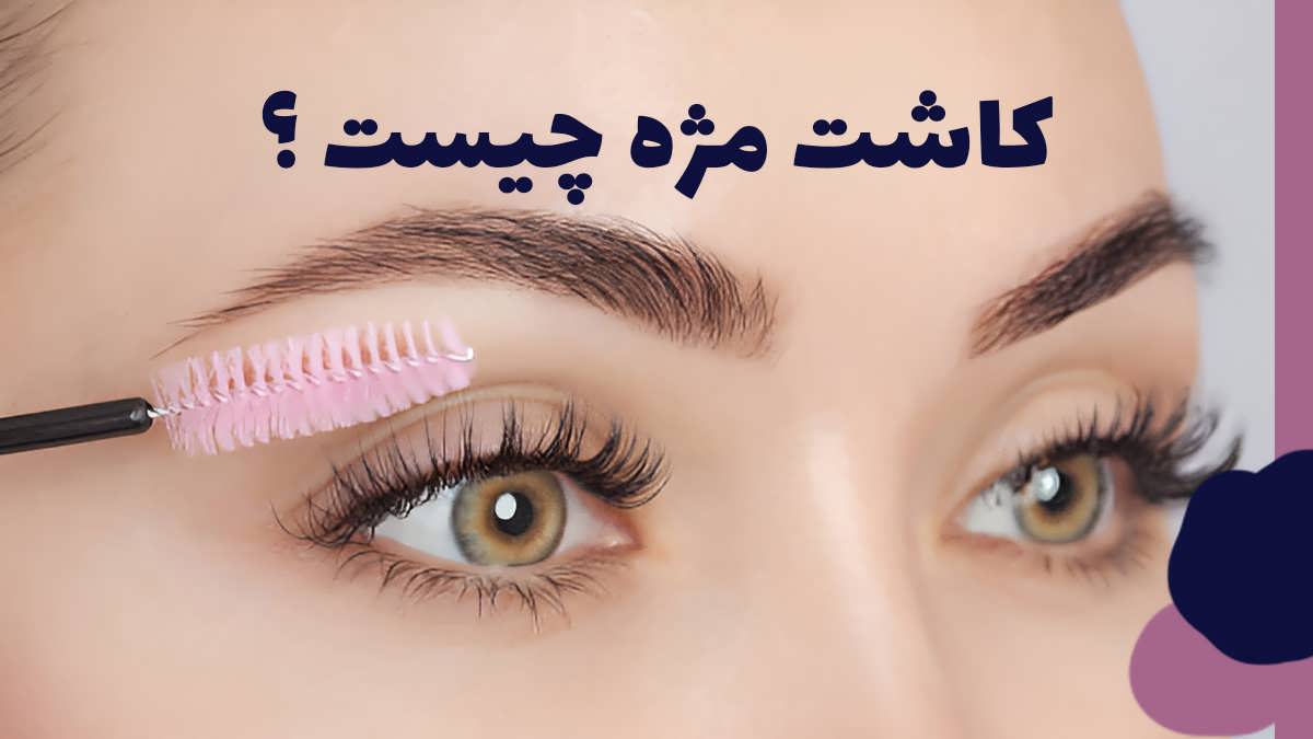 کاشت مژه چیست و مقایسه کاشت مژه دائمی و اکستنشن