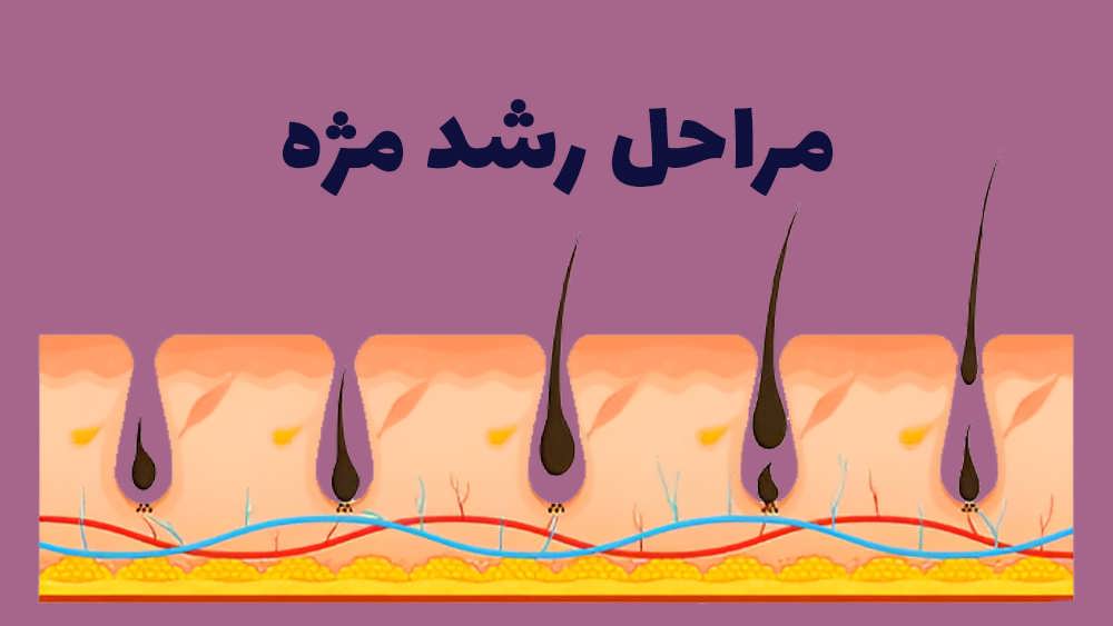 کاشت مژه دائمی چگونه است؟